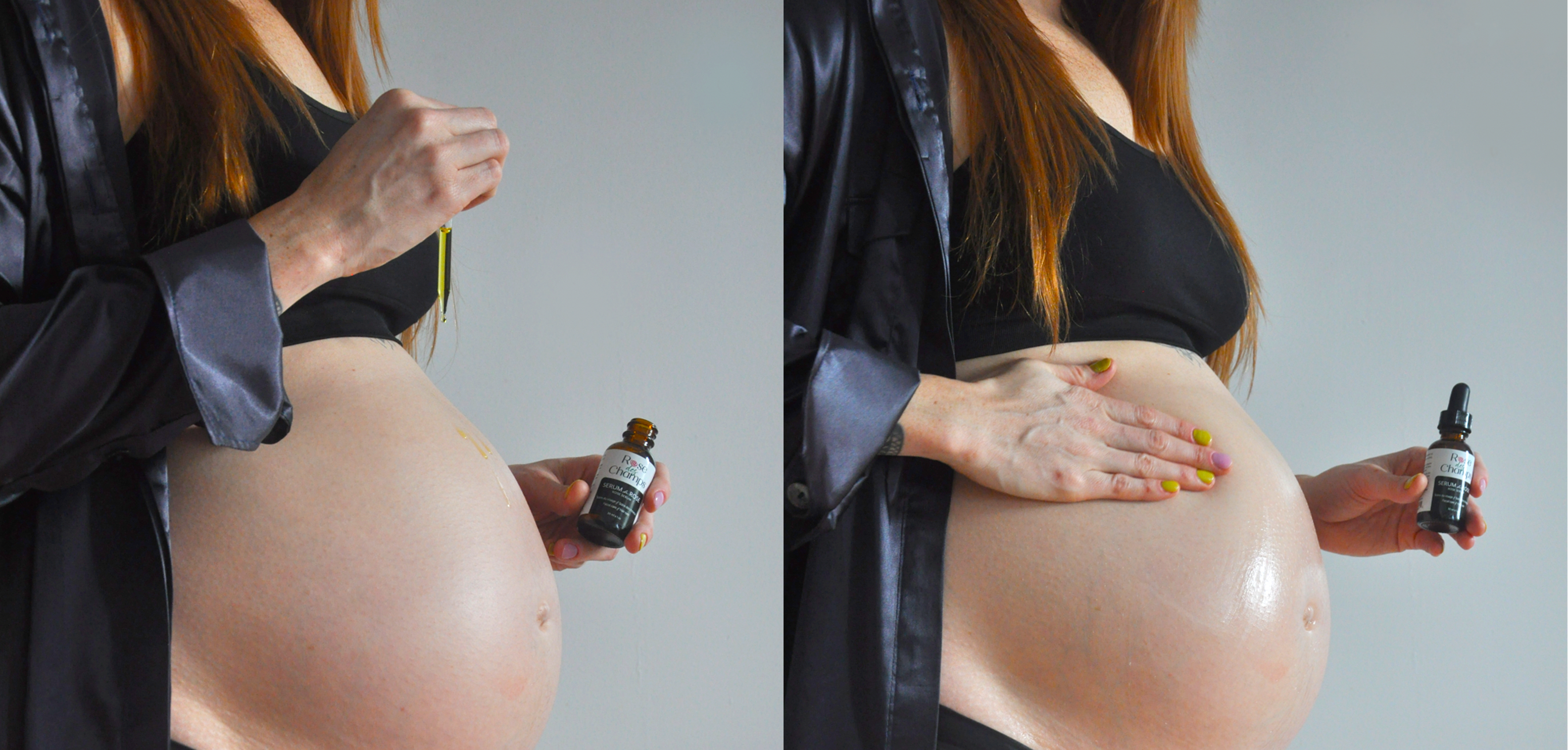 rose-serum-pregnancy-motherhood